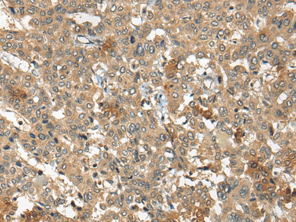 ARCN1 Polyclonal Antibody (E-AB-19716)