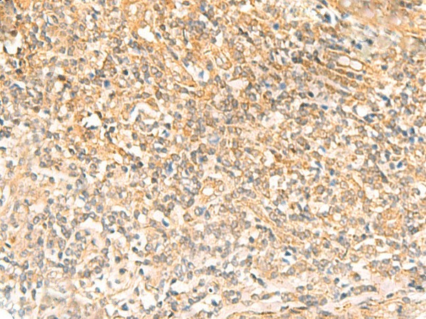 UBD Polyclonal Antibody (E-AB-52823)