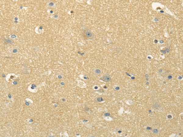 MSI1 Polyclonal Antibody (E-AB-17517)