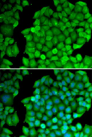 Cyclin D2 Polyclonal Antibody (E-AB-64532)