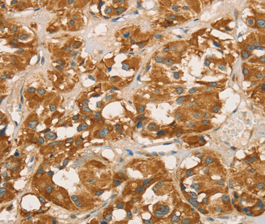RBBP8 Polyclonal Antibody (E-AB-11108)