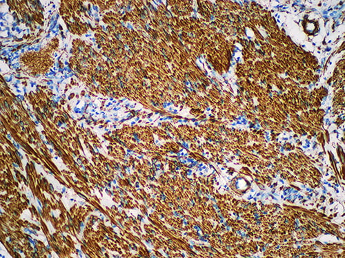 Caldesmon Monoclonal Antibody (ELAB6006-M)