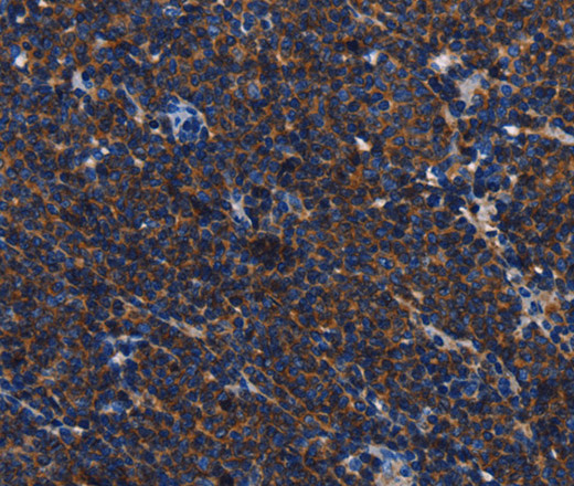 CD45 Polyclonal Antibody (E-AB-13127)