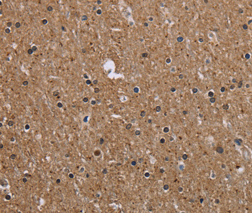 CMTM5 Polyclonal Antibody (E-AB-12449)
