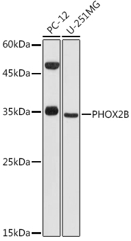 PHOX2B Polyclonal Antibody (E-AB-68428)