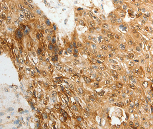 TENM3 Polyclonal Antibody (E-AB-16090)
