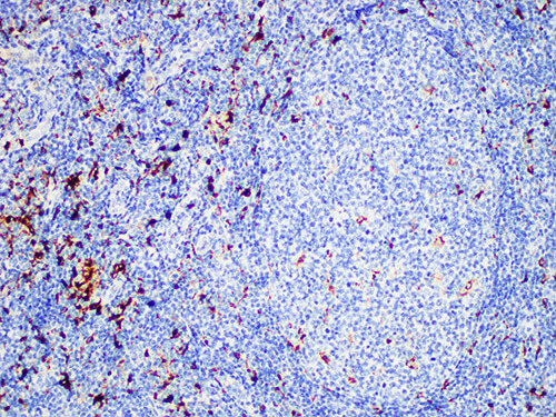 Lysozyme Monoclonal Antibody (ELAB6968-M)