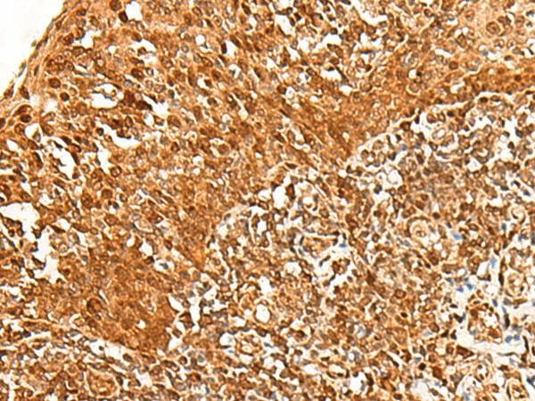 ADRM1 Polyclonal Antibody (E-AB-52740)