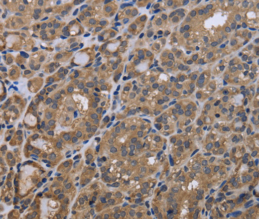 GADD45B Polyclonal Antibody (E-AB-15054)