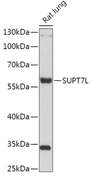 SUPT7L Polyclonal Antibody (E-AB-91828)