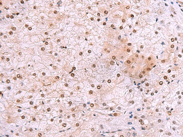 DDI2 Polyclonal Antibody (E-AB-52572)