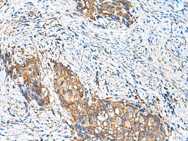CAMSAP3 Polyclonal Antibody (E-AB-18188)