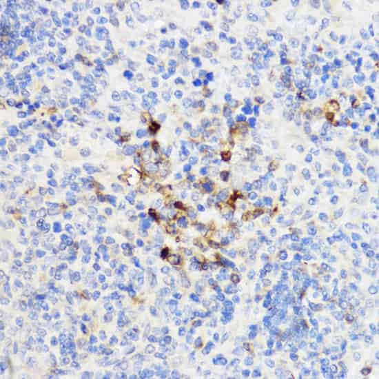 YKL-40 / CHI3L1 Polyclonal Antibody (E-AB-67084)