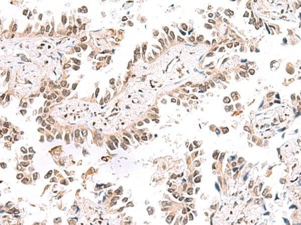 KCTD13 Polyclonal Antibody (E-AB-52892)