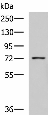 GUSB Polyclonal Antibody (E-AB-19084)