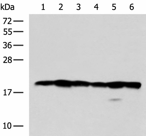 BLOC1S6 Polyclonal Antibody (E-AB-53057)