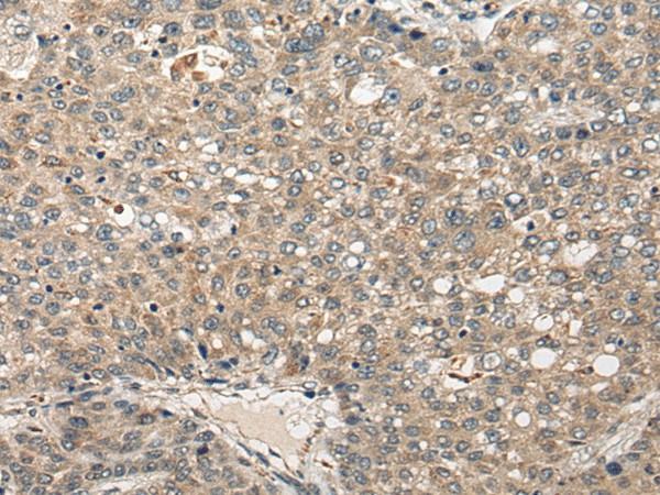 FUT4 Polyclonal Antibody (E-AB-17774)