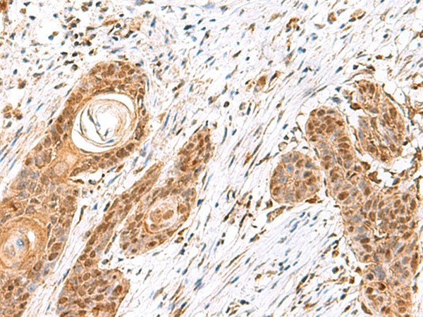 MECR Polyclonal Antibody (E-AB-19006)