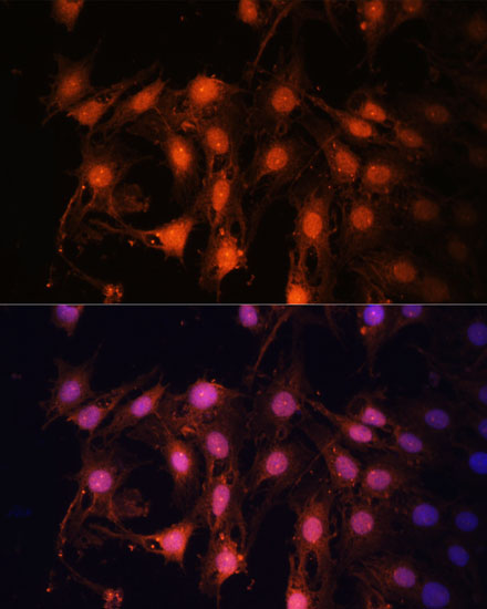 E2F1 Polyclonal Antibody (E-AB-67402)