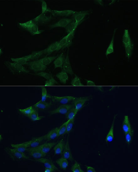ARL3 Polyclonal Antibody (E-AB-66774)
