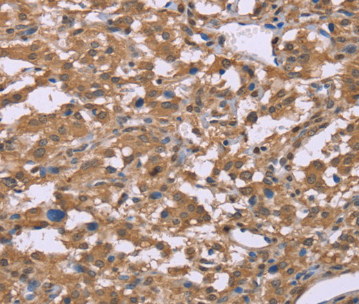 IFNA2 Polyclonal Antibody (E-AB-16505)
