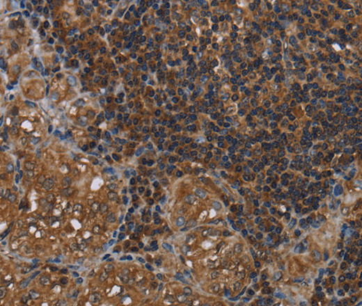 HOMER2 Polyclonal Antibody (E-AB-11297)