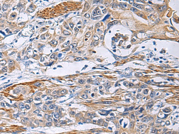 FBXO45 Polyclonal Antibody (E-AB-17952)
