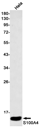 Recombinant S100A4 Monoclonal Antibody (E-AB-81606)