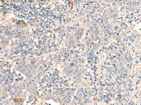 PARS2 Polyclonal Antibody (E-AB-18731)