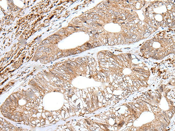 ENPEP Polyclonal Antibody (E-AB-19620)
