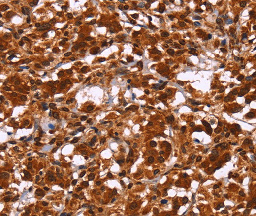 HIPK1 Polyclonal Antibody (E-AB-16479)