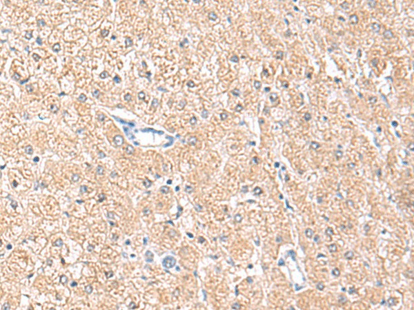 MLKL Polyclonal Antibody (E-AB-18957)