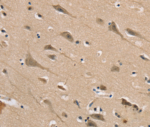 DLG2 Polyclonal Antibody (E-AB-13539)