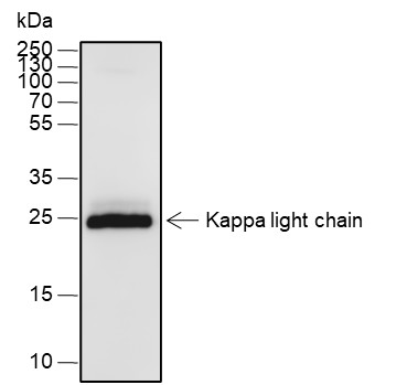 Recombinant Kappa light chain Monoclonal Antibody (AN301847L)