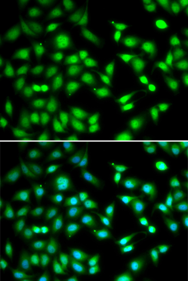 CDKN2D Polyclonal Antibody (E-AB-61210)
