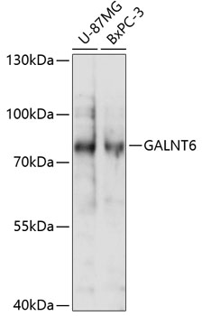 GALNT6 Polyclonal Antibody (E-AB-90975)