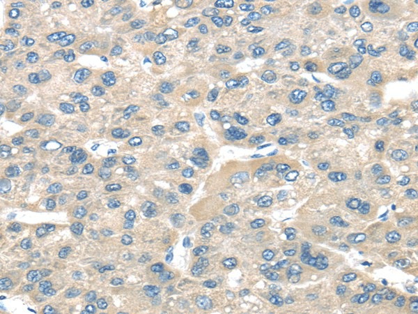 TNFAIP8 Polyclonal Antibody (E-AB-17126)