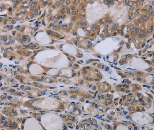 NAIP Polyclonal Antibody (E-AB-13435)