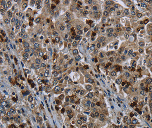 CD42b Polyclonal Antibody (E-AB-15083)