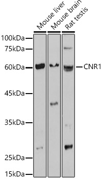 CNR1 Polyclonal Antibody (E-AB-68313)