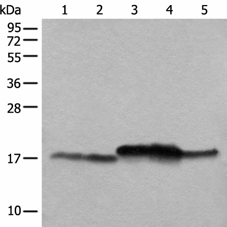 NDUFB11 Polyclonal Antibody (E-AB-52254)