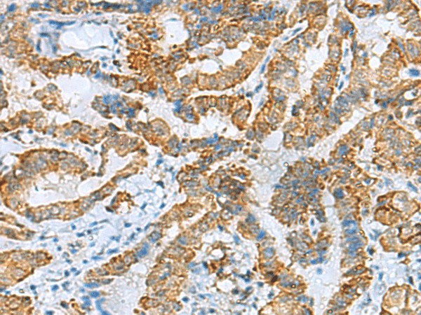 FBXO8 Polyclonal Antibody (E-AB-53145)