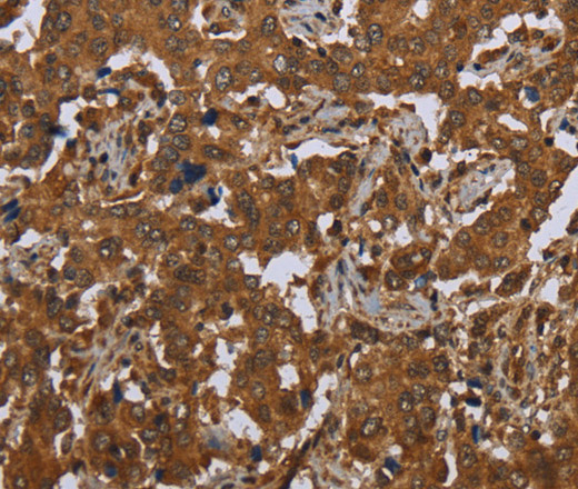 SCGB1D2 Polyclonal Antibody (E-AB-16568)