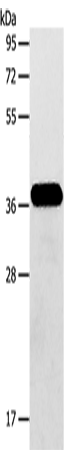 AASDHPPT Polyclonal Antibody (E-AB-10693)