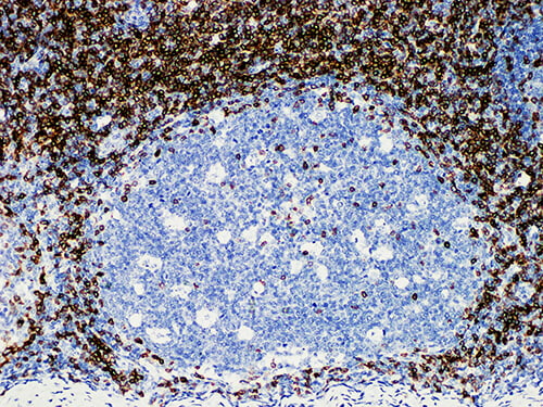 CD5 Monoclonal Antibody (ELAB6286-M)
