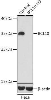 (KO Validated) BCL10 Polyclonal Antibody (E-AB-60188)