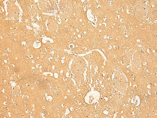 RNASE4 Polyclonal Antibody (E-AB-52813)