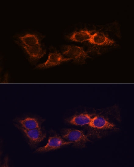 RIP3 Polyclonal Antibody (E-AB-60962)