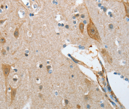 NOL3 Polyclonal Antibody (E-AB-14591)