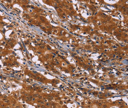 DCBLD2 Polyclonal Antibody (E-AB-14932)